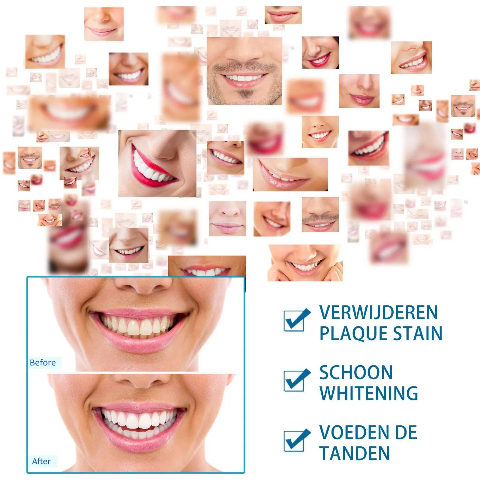 Jaysuing Teeth Whitening Pen - Image 3