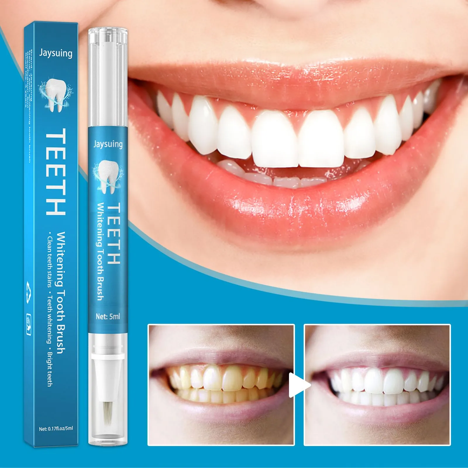 Jaysuing Teeth Whitening Pen - Image 4